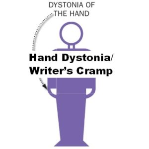 focal hand dystonia