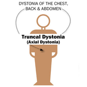 Truncal Dystonia Brochure