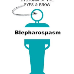 Blepharospasm: Dystonia of the eyes & brow