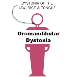 Oromandibular Dystonia Brochure